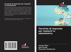 Buchcover von Tecniche di impronta per impianti in odontoiatria