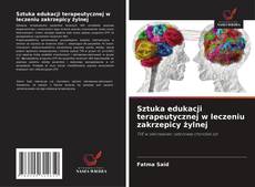 Couverture de Sztuka edukacji terapeutycznej w leczeniu zakrzepicy żylnej