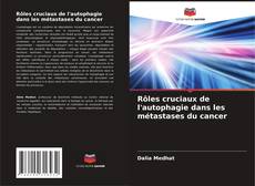 Copertina di Rôles cruciaux de l'autophagie dans les métastases du cancer