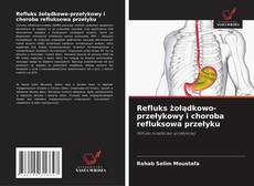 Buchcover von Refluks żołądkowo-przełykowy i choroba refluksowa przełyku