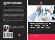 Обложка Taxas de recorrência do cancro após cirurgia conservadora da mama