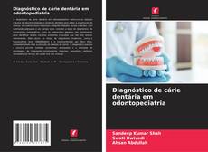 Bookcover of Diagnóstico de cárie dentária em odontopediatria