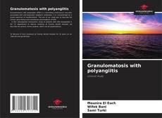 Bookcover of Granulomatosis with polyangiitis