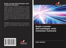 Buchcover von Ruolo cruciale dell'autofagia nella metastasi tumorale