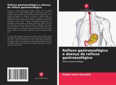 Couverture de Refluxo gastroesofágico e doença de refluxo gastroesofágico
