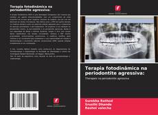 Обложка Terapia fotodinâmica na periodontite agressiva: