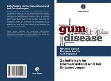 Bookcover of Zahnfleisch im Normalzustand und bei Entzündungen