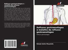 Buchcover von Reflusso gastroesofageo e malattia da reflusso gastroesofageo