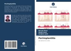 Bookcover of Periimplantitis