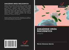 Bookcover of ZAKAŻENIE DRÓG MOCZOWYCH