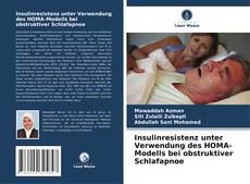 Insulinresistenz unter Verwendung des HOMA-Modells bei obstruktiver Schlafapnoe kitap kapağı