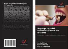 Buchcover von Nagłe przypadki endodontyczne i ich leczenie