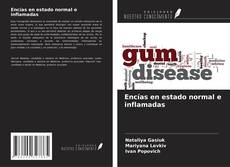 Capa do livro de Encías en estado normal e inflamadas 