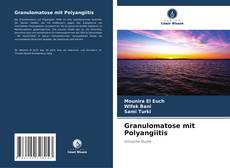 Bookcover of Granulomatose mit Polyangiitis