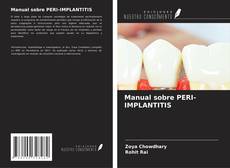Manual sobre PERI-IMPLANTITIS的封面