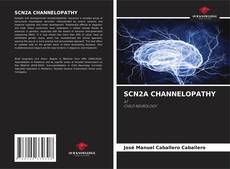 Bookcover of SCN2A CHANNELOPATHY