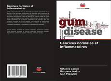 Bookcover of Gencives normales et inflammatoires