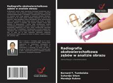 Bookcover of Radiografia okołowierzchołkowa zębów w analizie obrazu