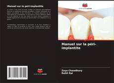 Couverture de Manuel sur la péri-implantite