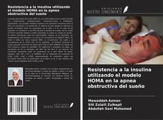 Обложка Resistencia a la insulina utilizando el modelo HOMA en la apnea obstructiva del sueño
