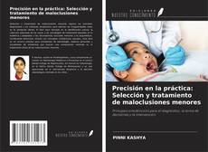 Couverture de Precisión en la práctica: Selección y tratamiento de maloclusiones menores
