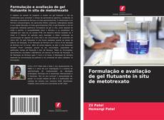 Couverture de Formulação e avaliação de gel flutuante in situ de metotrexato