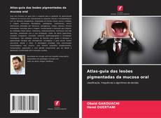 Couverture de Atlas-guia das lesões pigmentadas da mucosa oral