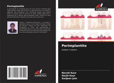 Capa do livro de Perimplantite 