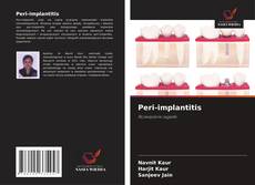 Bookcover of Peri-implantitis