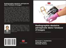 Radiographie dentaire périapicale dans l'analyse d'images的封面
