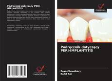 Podręcznik dotyczący PERI-IMPLANTITIS的封面