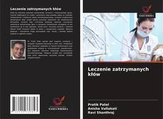 Capa do livro de Leczenie zatrzymanych kłów 