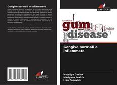 Bookcover of Gengive normali e infiammate
