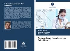 Buchcover von Behandlung impaktierter Eckzähne
