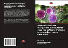 Modifications des marqueurs moléculaires chez les patients irakiens atteints d'un cancer colorectal的封面