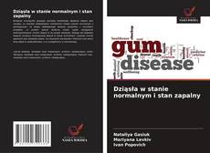 Bookcover of Dziąsła w stanie normalnym i stan zapalny