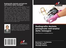 Radiografia dentale periapicale nell'analisi delle immagini的封面