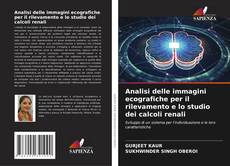 Analisi delle immagini ecografiche per il rilevamento e lo studio dei calcoli renali kitap kapağı