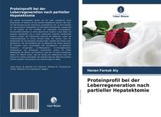 Couverture de Proteinprofil bei der Leberregeneration nach partieller Hepatektomie