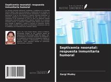 Couverture de Septicemia neonatal: respuesta inmunitaria humoral