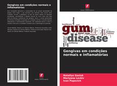 Bookcover of Gengivas em condições normais e inflamatórias