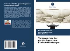 Bookcover of Tumormarker bei gynäkologischen Krebserkrankungen