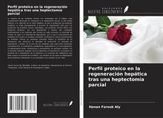 Обложка Perfil proteico en la regeneración hepática tras una heptectomía parcial