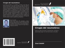 Capa do livro de Cirugía del neumotórax 