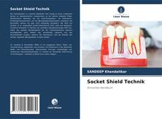 Couverture de Socket Shield Technik