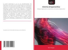 Anemia drepanocítica的封面