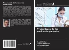 Tratamiento de los caninos impactados kitap kapağı