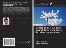 Portada del libro de Cirugía de cerclaje radial para el desprendimiento de retina regmatógeno