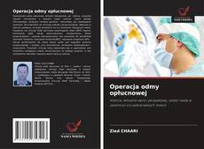 Bookcover of Operacja odmy opłucnowej
