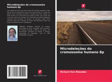 Bookcover of Microdeleções do cromossoma humano 8p